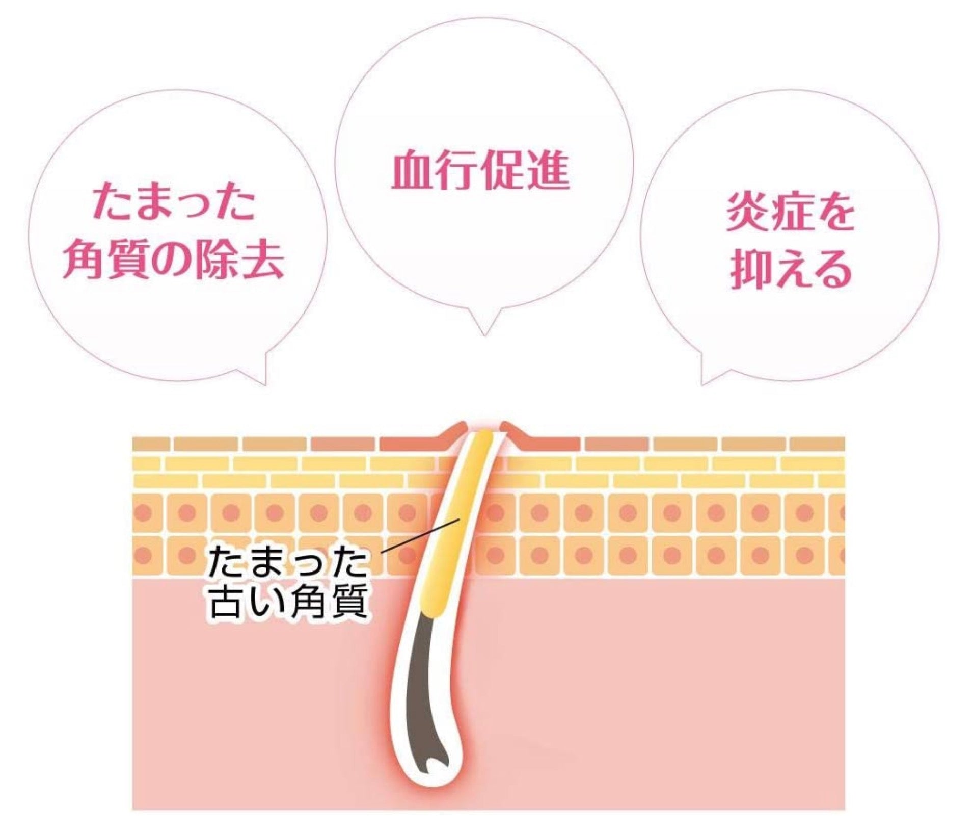 小林制药去鸡皮膏30g