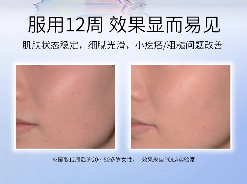 POLA女性周期平衡片调节荷尔蒙180片蜷川实花限定版