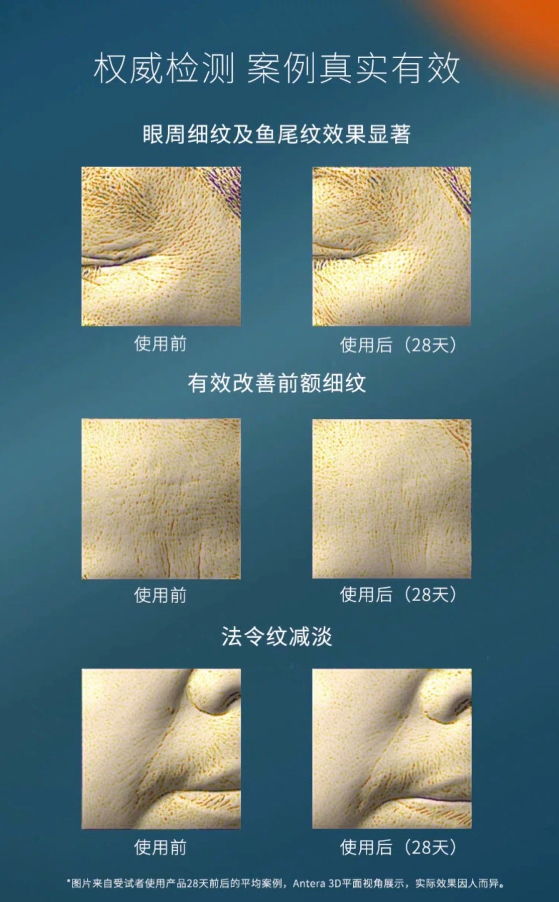 POLA祛皱抗皱精华20g