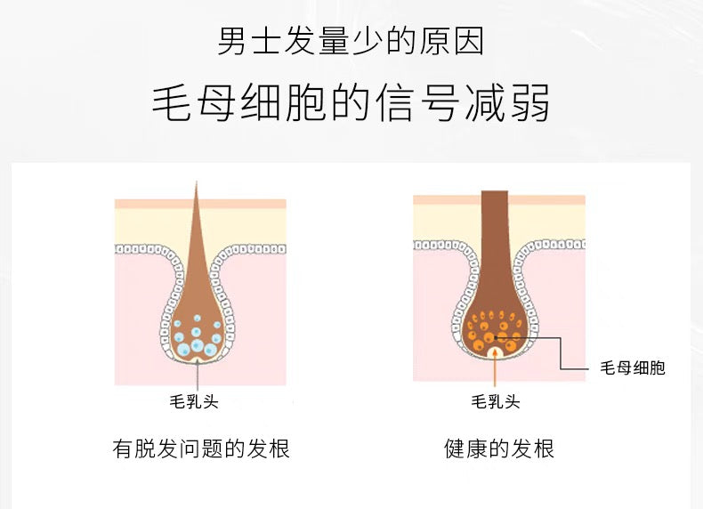 POLA男士专用头皮护理生发精华200ml