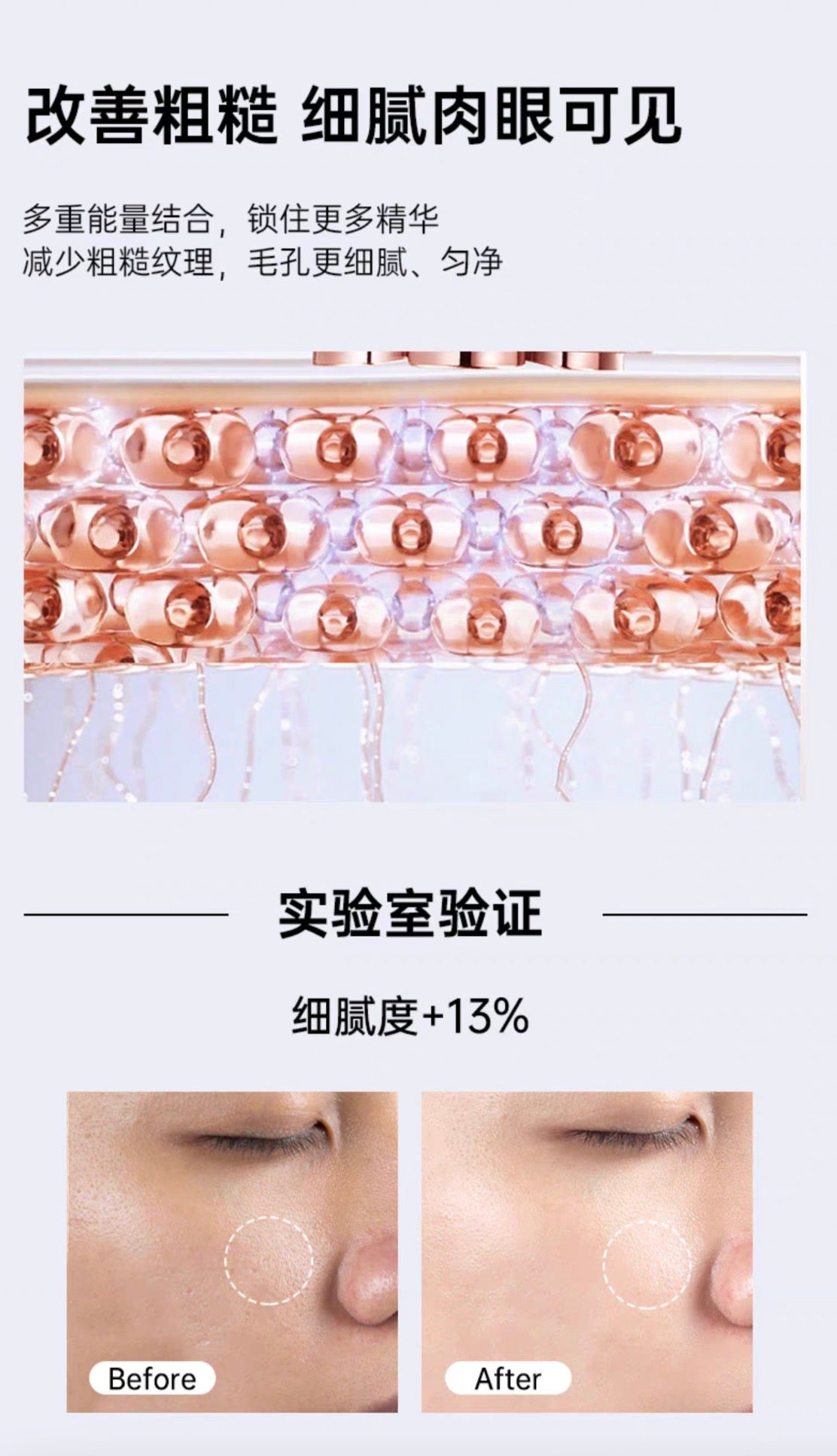 雅萌YAMAN M20美容仪