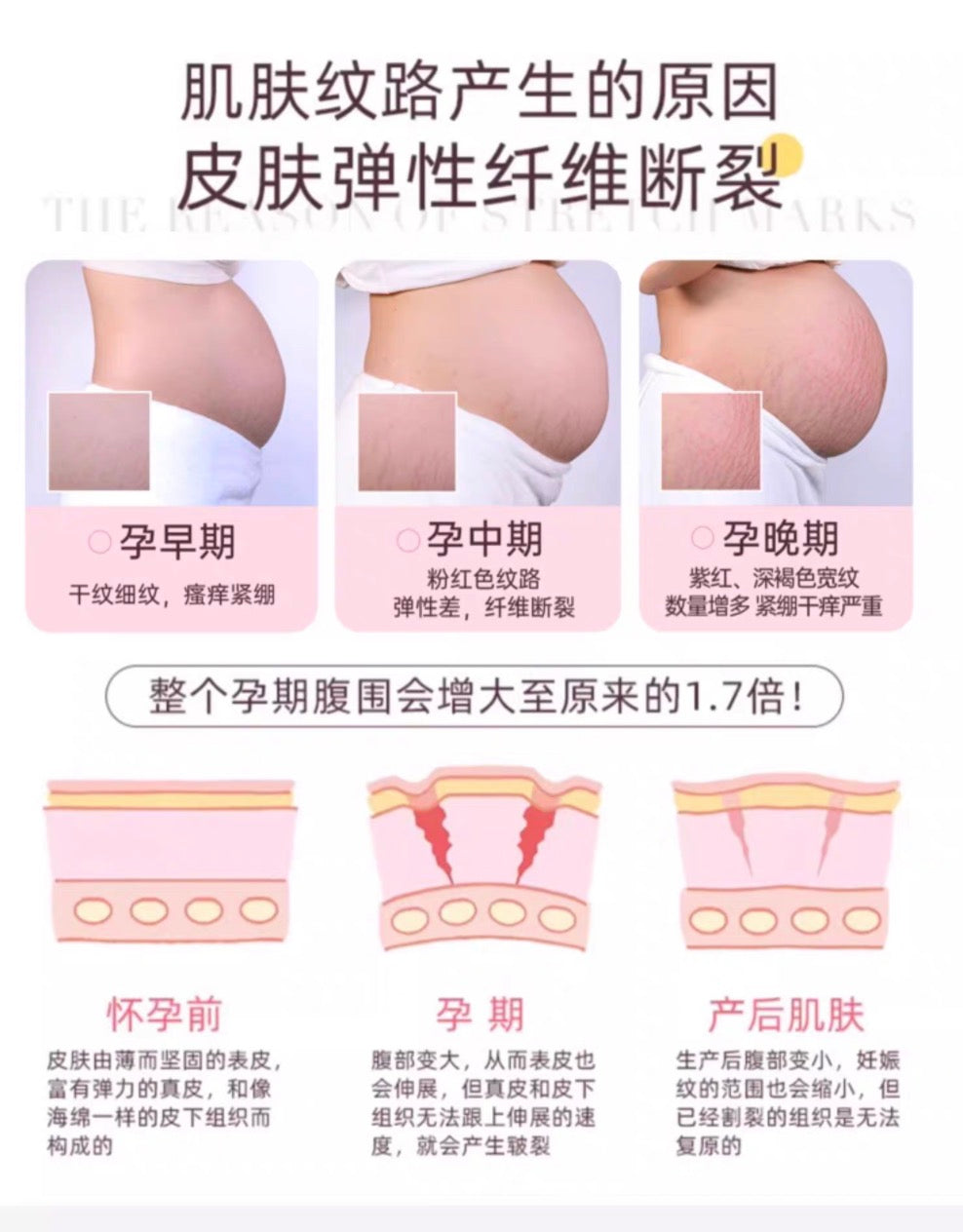 Mama&Kids预防淡化祛妊娠纹乳霜